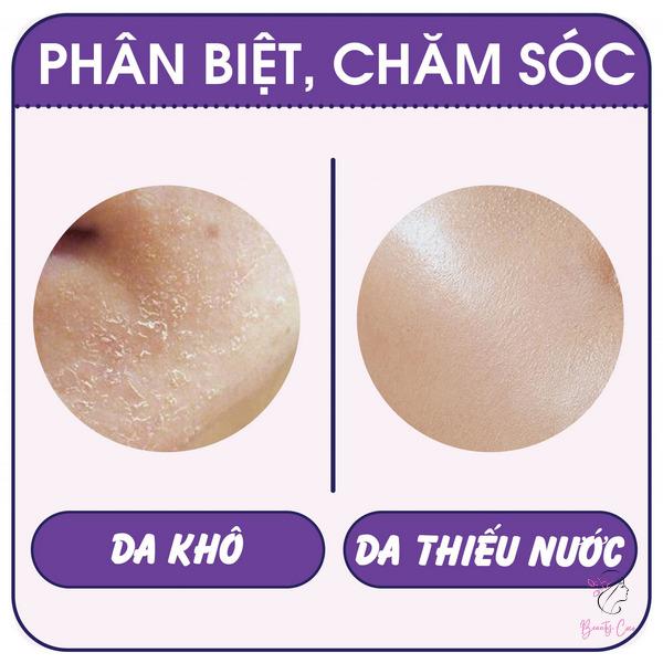 cham-soc-da-kho